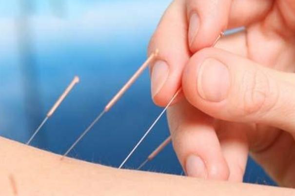 針灸對(duì)神經(jīng)損傷恢復(fù)有作用嗎 針灸對(duì)耳鳴治耳鳴有效果嗎 針灸對(duì)神經(jīng)損傷恢復(fù)有作用嗎 針灸對(duì)耳鳴治耳鳴有效果嗎