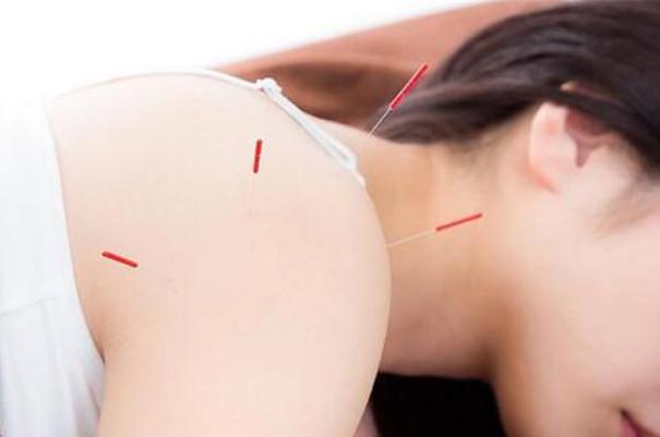 針灸會(huì)導(dǎo)致神經(jīng)受損嗎 針灸會(huì)出血嗎 針灸會(huì)導(dǎo)致神經(jīng)受損嗎 針灸會(huì)出血嗎