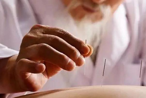 針灸對(duì)神經(jīng)損傷恢復(fù)有作用嗎 針灸對(duì)耳鳴治耳鳴有效果嗎 針灸對(duì)神經(jīng)損傷恢復(fù)有作用嗎 針灸對(duì)耳鳴治耳鳴有效果嗎