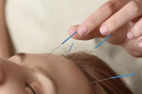 針灸有危險嗎 針灸有什么好處和壞處 針灸有危險嗎 針灸有什么好處和壞處