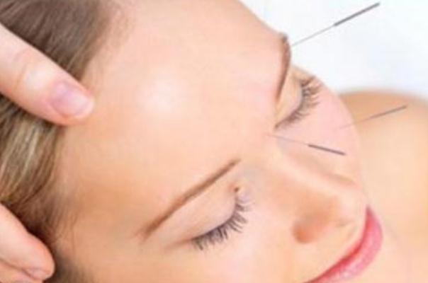 針灸可以洗澡不 針灸能治哪些病 針灸可以洗澡不 針灸能治哪些病