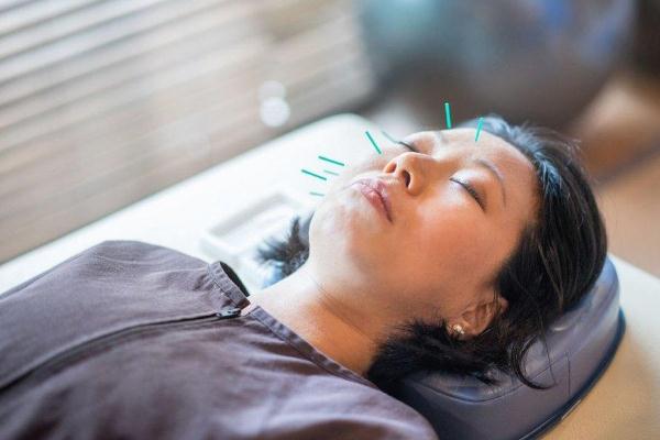 針灸可以去濕氣嗎 針灸可以每天做嗎 針灸可以去濕氣嗎 針灸可以每天做嗎