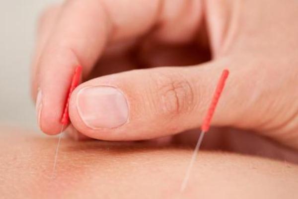 針灸對腰椎間盤突出有用嗎 針灸對頸椎病有效果嗎 針灸對腰椎間盤突出有用嗎 針灸對頸椎病有效果嗎