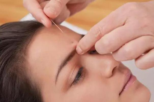 針灸會(huì)影響月經(jīng)推遲嗎 針灸會(huì)導(dǎo)致月經(jīng)不調(diào)嗎 針灸會(huì)影響月經(jīng)推遲嗎 針灸會(huì)導(dǎo)致月經(jīng)不調(diào)嗎