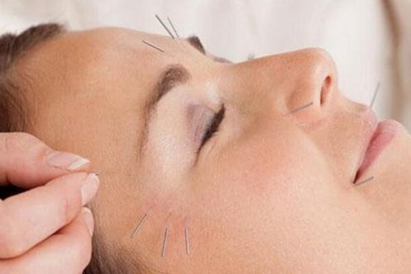 針灸會(huì)影響月經(jīng)推遲嗎 針灸會(huì)導(dǎo)致月經(jīng)不調(diào)嗎 針灸會(huì)影響月經(jīng)推遲嗎 針灸會(huì)導(dǎo)致月經(jīng)不調(diào)嗎