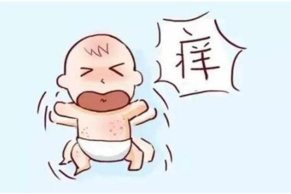 寶寶濕疹會傳染嗎 寶寶濕疹會自己消失嗎 寶寶濕疹會傳染嗎 寶寶濕疹會自己消失嗎