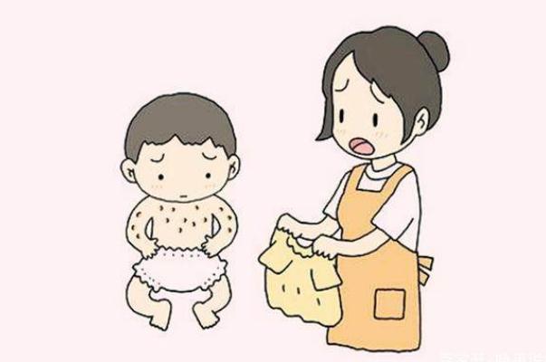 寶寶濕疹會傳染嗎 寶寶濕疹會自己消失嗎 寶寶濕疹會傳染嗎 寶寶濕疹會自己消失嗎