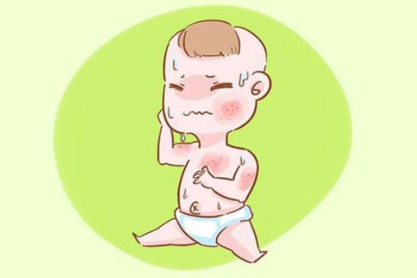 寶寶濕疹是不是熱出來的 寶寶濕疹是不是很癢 寶寶濕疹是不是熱出來的 寶寶濕疹是不是很癢