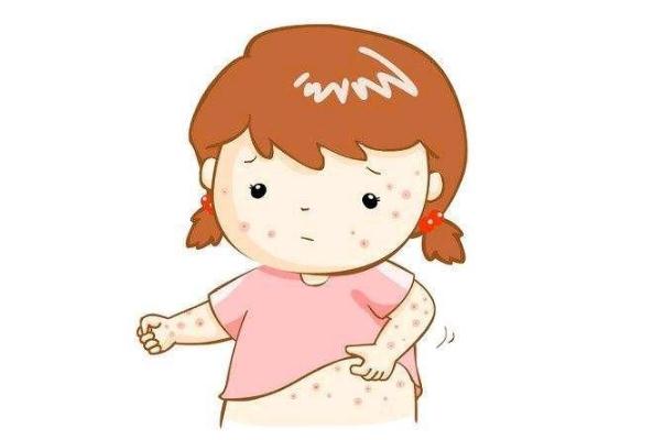 寶寶濕疹是不是熱出來的 寶寶濕疹是不是很癢 寶寶濕疹是不是熱出來的 寶寶濕疹是不是很癢