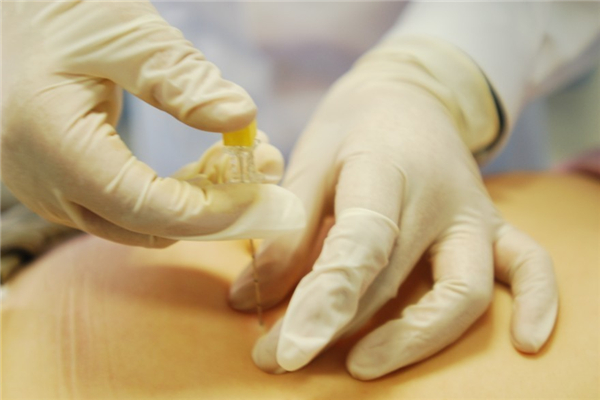 埋線減肥疼不疼 埋線減肥疼痛持續(xù)多久 埋線減肥疼不疼 埋線減肥疼痛持續(xù)多久