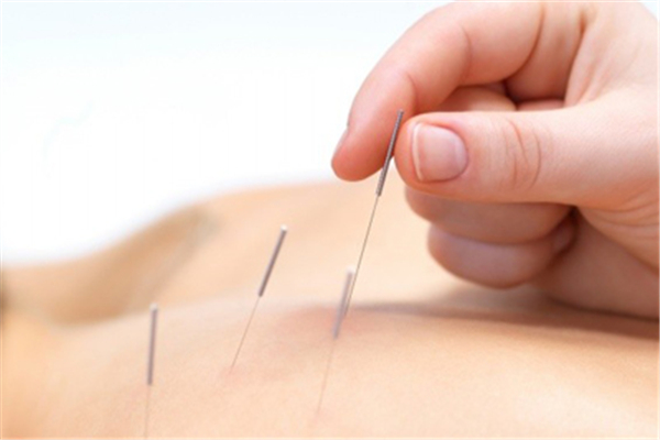 埋線減肥效果好不好 埋線減肥要做幾次才有效果 埋線減肥效果好不好 埋線減肥要做幾次才有效果