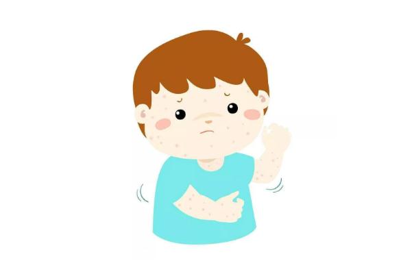 水痘會(huì)傳染給大人嗎 水痘會(huì)傳染給嬰兒?jiǎn)?>
               <p class=