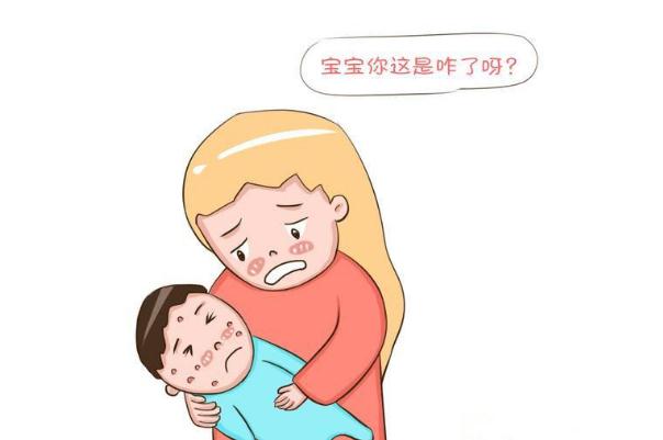 水痘可以擠破嗎 水痘可以吃什么食物 水痘可以擠破嗎 水痘可以吃什么食物