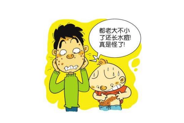 水痘的潛伏期會傳染嗎 水痘的傳播途徑 水痘的潛伏期會傳染嗎 水痘的傳播途徑