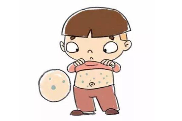 水痘的潛伏期會傳染嗎 水痘的傳播途徑 水痘的潛伏期會傳染嗎 水痘的傳播途徑