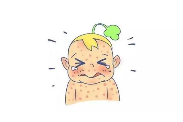 水痘的潛伏期會傳染嗎 水痘的傳播途徑 水痘的潛伏期會傳染嗎 水痘的傳播途徑