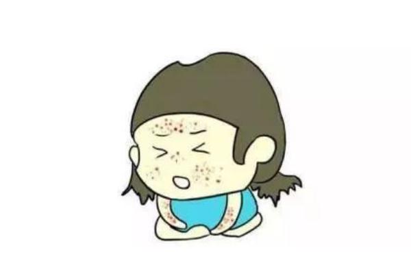 水痘可以擠破嗎 水痘可以吃什么食物 水痘可以擠破嗎 水痘可以吃什么食物