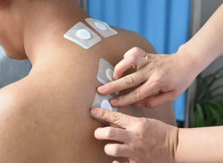 三伏貼幾天貼一次 三伏貼要貼幾個小時能拿下來 三伏貼幾天貼一次 三伏貼要貼幾個小時能拿下來