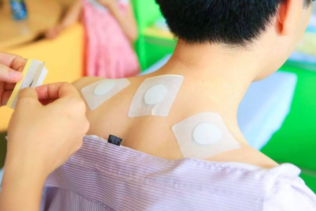 三伏貼幾天貼一次 三伏貼要貼幾個小時能拿下來 三伏貼幾天貼一次 三伏貼要貼幾個小時能拿下來