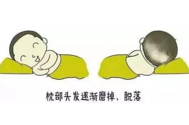 嬰兒禿枕會自愈嗎 嬰兒禿枕多久會好 嬰兒禿枕會自愈嗎 嬰兒禿枕多久會好