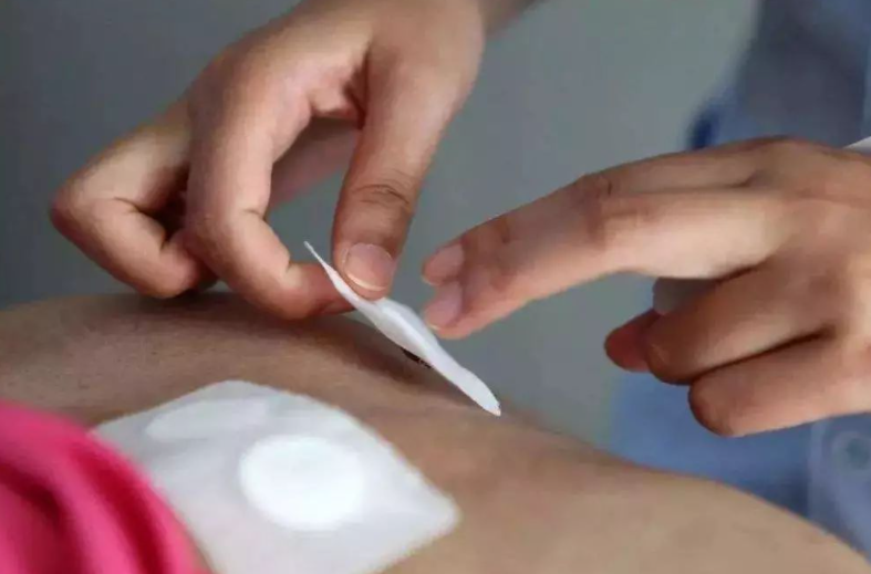 三伏貼幾天貼一次 三伏貼要貼幾個小時能拿下來 三伏貼幾天貼一次 三伏貼要貼幾個小時能拿下來