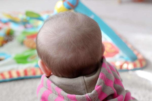 嬰兒枕禿是什么原因引起的 嬰兒枕禿什么時(shí)候能好 嬰兒枕禿是什么原因引起的 嬰兒枕禿什么時(shí)候能好