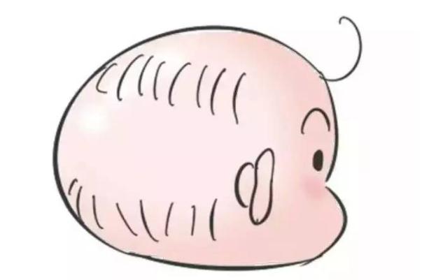 嬰兒枕禿是佝僂病嗎 嬰兒枕禿會自己好嗎 嬰兒枕禿是佝僂病嗎 嬰兒枕禿會自己好嗎