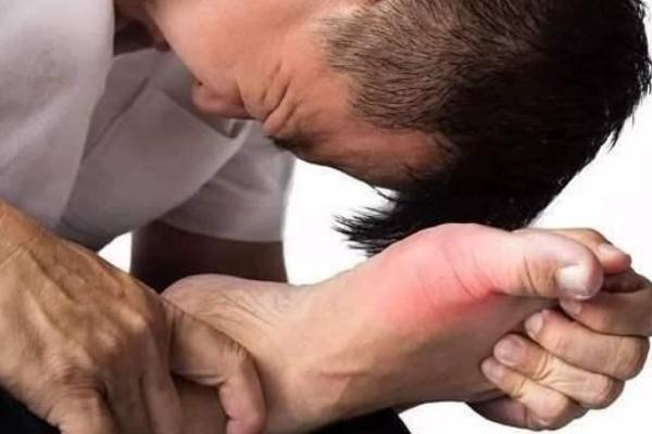 痛風(fēng)要做哪些檢查項(xiàng)目 痛風(fēng)有遺傳性嗎 痛風(fēng)要做哪些檢查項(xiàng)目 痛風(fēng)有遺傳性嗎