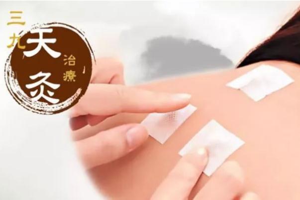 三九貼要注意什么 三九貼要貼多長時間 三九貼要注意什么 三九貼要貼多長時間
