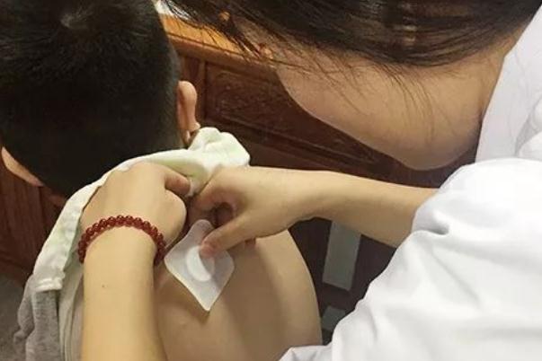 三九貼有必要貼嗎 三九貼不連續(xù)貼三年有用嗎 三九貼有必要貼嗎 三九貼不連續(xù)貼三年有用嗎