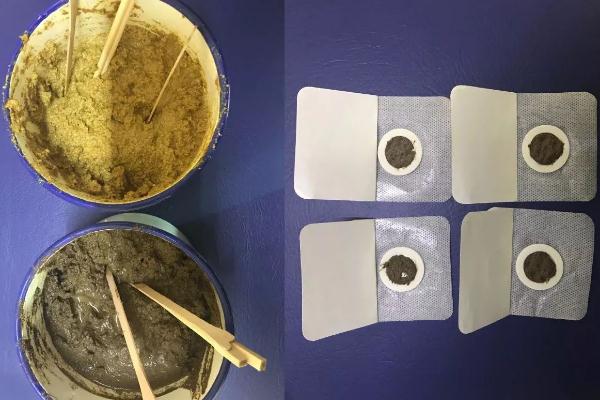 三九貼有必要貼嗎 三九貼不連續(xù)貼三年有用嗎 三九貼有必要貼嗎 三九貼不連續(xù)貼三年有用嗎