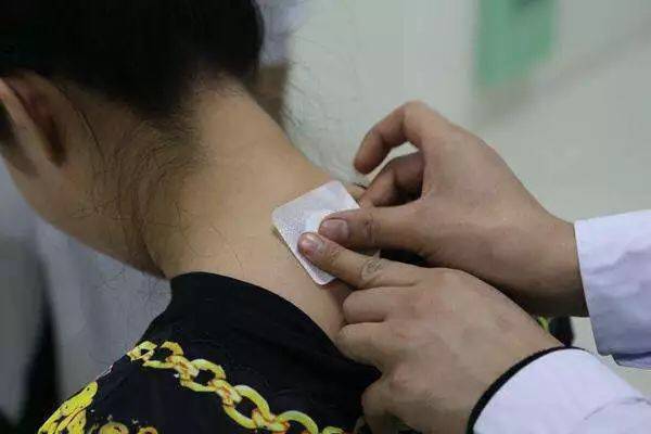 三九貼的作用功效 三九貼可以治療哪些疾病 三九貼的作用功效 三九貼可以治療哪些疾病