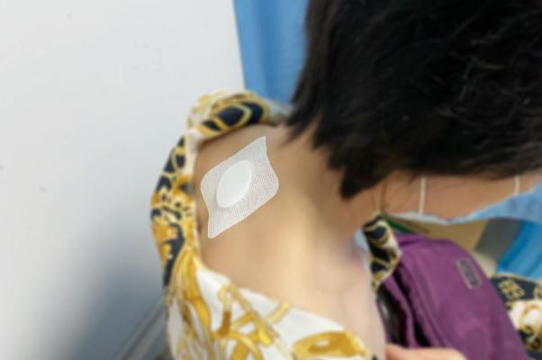 三九貼可以天天貼嗎 三九貼隔幾天貼一次 三九貼可以天天貼嗎 三九貼隔幾天貼一次