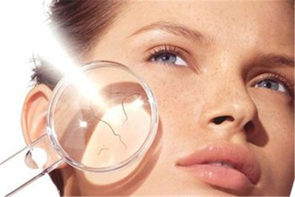 曬后用蘆薈膠修復(fù)有用嗎 曬后用什么修復(fù)比較好 曬后用蘆薈膠修復(fù)有用嗎 曬后用什么修復(fù)比較好