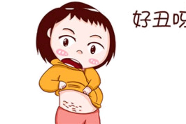 肥胖紋瘦下來(lái)可以消除嗎 肥胖紋怎去掉 肥胖紋瘦下來(lái)可以消除嗎 肥胖紋怎去掉