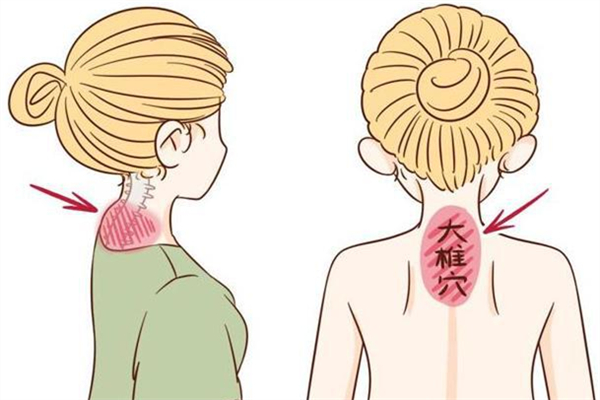 富貴包會(huì)造成手腳發(fā)麻嗎 富貴包導(dǎo)致手麻怎么辦 富貴包會(huì)造成手腳發(fā)麻嗎 富貴包導(dǎo)致手麻怎么辦