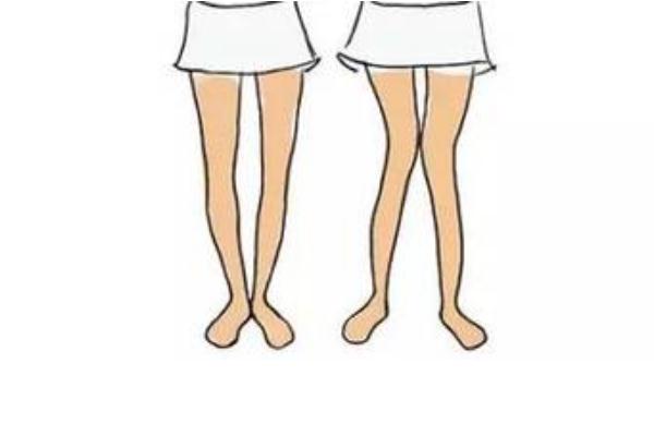 佝僂病的病因主要是 佝僂病的預(yù)防措施 佝僂病的病因主要是 佝僂病的預(yù)防措施