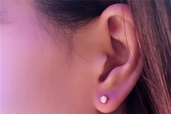 打耳洞發(fā)炎流膿怎么辦 打耳洞發(fā)炎用什么藥 打耳洞發(fā)炎流膿怎么辦 打耳洞發(fā)炎用什么藥