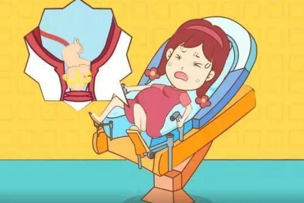 順產(chǎn)和剖腹產(chǎn)哪個對女人好 順產(chǎn)撕裂縫針多久恢復(fù) 順產(chǎn)和剖腹產(chǎn)哪個對女人好 順產(chǎn)撕裂縫針多久恢復(fù)