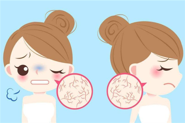 皮膚干燥的原因是什么 皮膚干燥會引起什么皮膚問題