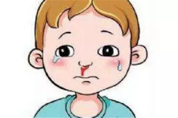 流鼻血有血塊是什么原因引起的 流鼻血會(huì)導(dǎo)致貧血嗎 流鼻血有血塊是什么原因引起的 流鼻血會(huì)導(dǎo)致貧血嗎