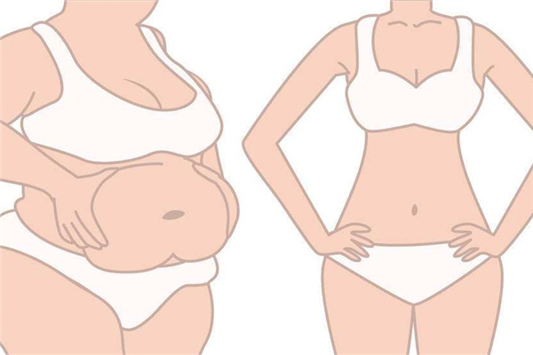 網(wǎng)紅去世背后的抽脂生意 網(wǎng)紅抽脂去世 網(wǎng)紅去世背后的抽脂生意 網(wǎng)紅抽脂去世