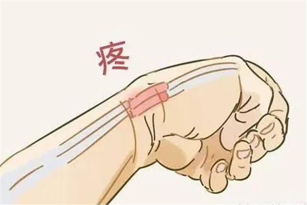 腱鞘炎要注意什么 腱鞘炎要多久才能好 腱鞘炎要注意什么 腱鞘炎要多久才能好