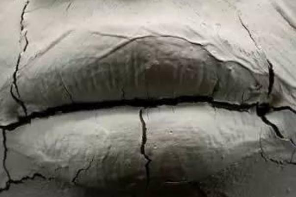 唇炎怎么快速治好 導(dǎo)致患上唇炎的因素 唇炎怎么快速治好 導(dǎo)致患上唇炎的因素