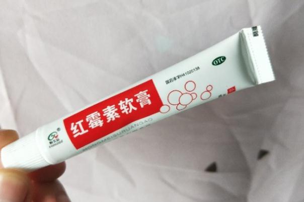 唇炎可以吃雞蛋嗎 唇炎可以吃芒果嗎 唇炎可以吃雞蛋嗎 唇炎可以吃芒果嗎