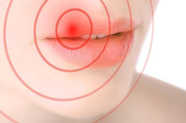 唇炎可以涂潤(rùn)唇膏嗎 唇炎可以涂凡士林嗎 唇炎可以涂潤(rùn)唇膏嗎 唇炎可以涂凡士林嗎