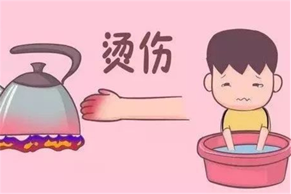 燙傷起水泡了怎么辦 燙傷起水泡要不要挑破 燙傷起水泡了怎么辦 燙傷起水泡要不要挑破