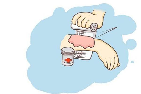 燙傷后紅色疤痕多久恢復(fù)正常 燙傷后為什么會紅腫