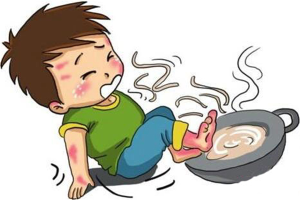 燙傷起水泡了怎么辦 燙傷起水泡要不要挑破 燙傷起水泡了怎么辦 燙傷起水泡要不要挑破