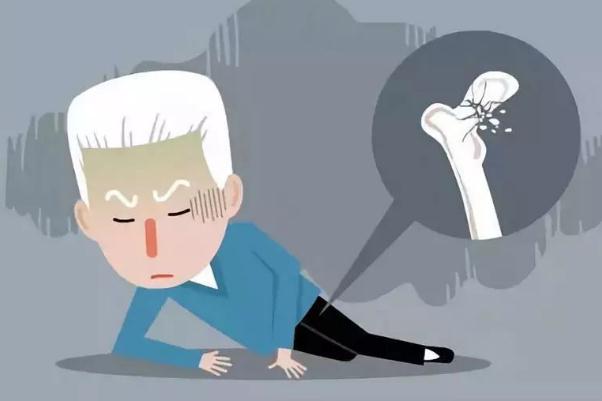 骨質(zhì)疏松是缺什么元素 骨質(zhì)疏松是什么意思 骨質(zhì)疏松是缺什么元素 骨質(zhì)疏松是什么意思